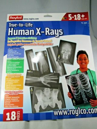 Roylco True To Life Human X - Rays - Set Of 18 Opened Box Has All Parts Shipp