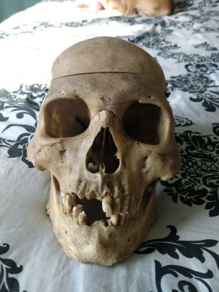 Antique Medical Skull