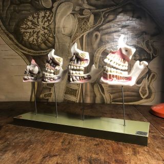 Vintage Somso Development Teeth Educational Anatomy Model Medical School Dental