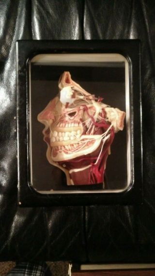 Antique Wax Anatomical Model Head Face Anatomical Model 19th Century Moulage