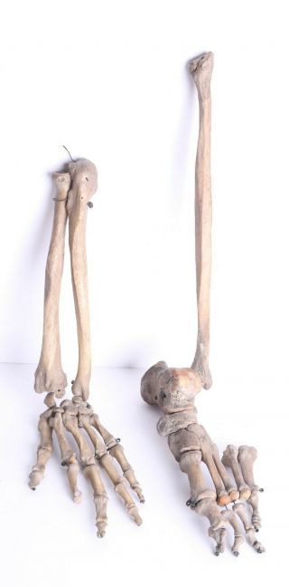 Antique Real Human Bones Illustrative Medical Device 19.  C.