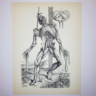 1950 Vintage Andreas Vesalius Print - Muscular System Hanging From Rope - Anatomy