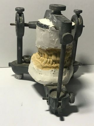 Antique Vintage Articulator Hanau Condylar Dental 9556