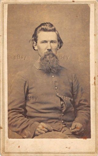 Antique Civil War Soldier Cdv Photo Union Army Of The Cumberland Id Shell Jacket