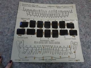 Vintage Human Dental X - Rays Set Dated Jan 1945