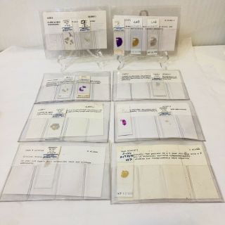 Vintage 1990s Human Pathology Glass Microscope Slides Clinical History Findings