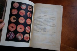 Urology: Diseases Of The Urinary Organs By Keyes,  Edward L.  1917 Colored Plates