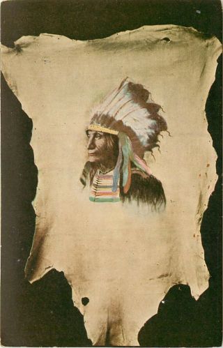 C1910 Postcard Native American Indian Broken Arm,  Ogallala Sioux Chief Unposted