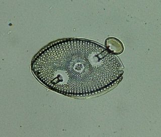 Antique Microscope Slide By W.  A.  Firth.  Diatom.  " Kittonia Elaborata.  Oamaru ".  N.  Z