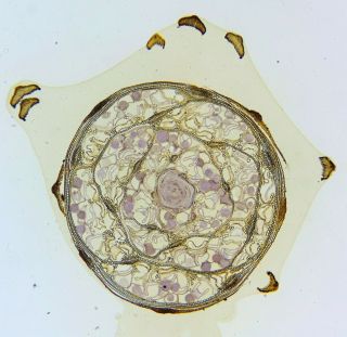 Antique Microscope Slide By Richard Suter.  T.  S.  Atheridia & Sporogonium Of Moss.