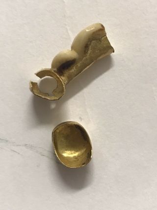Vintage Dental Scrap Gold With Human Tooth 5.  2 Grams Total