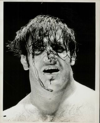1968 Press Photo Pro Wrestler Bruno Sammartino Close Up Of Bloody Face A/match