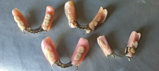 Vintage Antique Medical Oddities Dental Bridge Crown Partials W/ Teeth Dentures