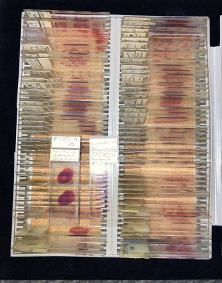 Vintage 1970’s Medical Human Anatomy Microscope Slides Histology Pathology